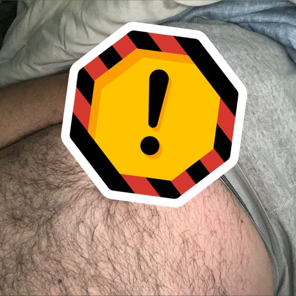 Acedogg — OnlyFans