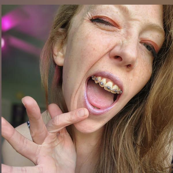 Luuna Moony โ OnlyFans