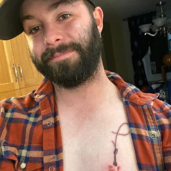 TheOnlySkippy — Canadian OnlyFans creator
