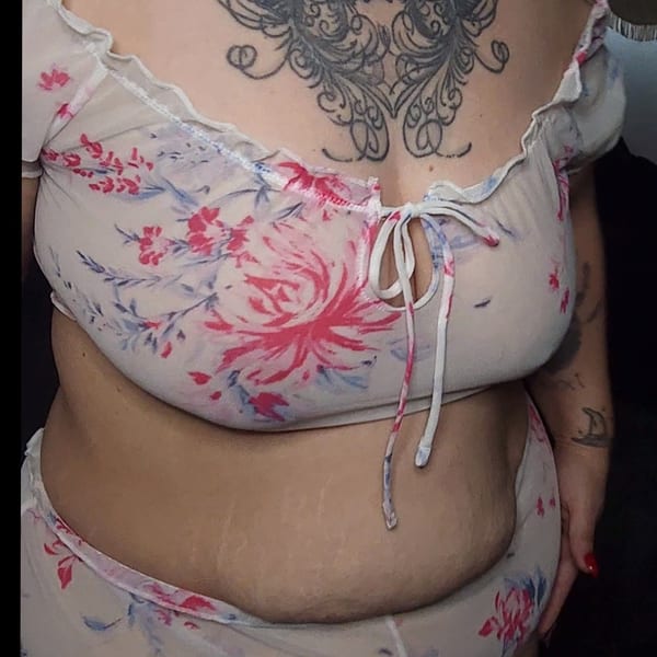 Orchid — OnlyFans